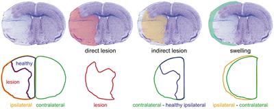 Hydroxycarboxylic Acid Receptor 1 and Neuroprotection in a Mouse Model of Cerebral Ischemia-Reperfusion